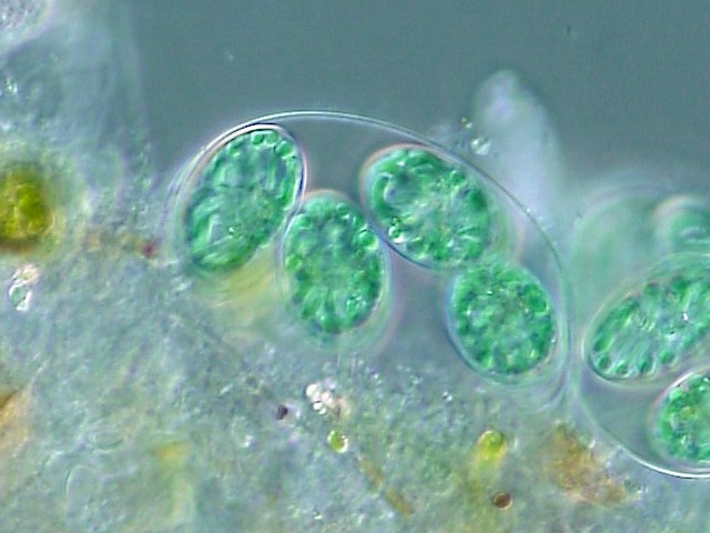 Glaucocystis Sp